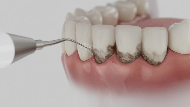 Trusted Tooth Extraction service in Union City, MI - Dentist Open Now
